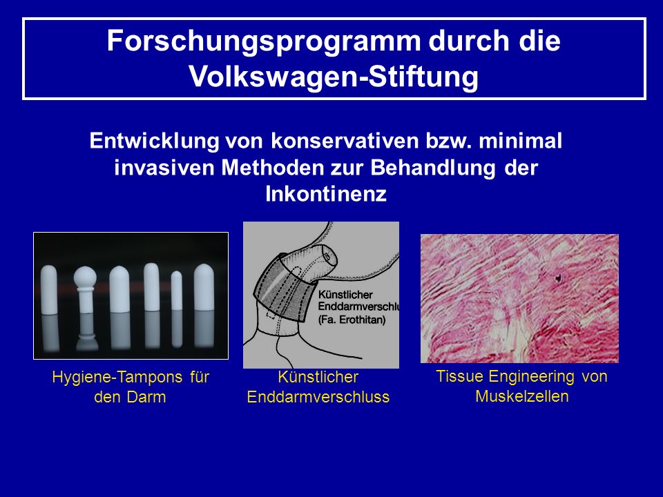 Paraproktit chirurgisch die Behandlungen